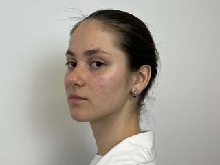 free live webcam chat ChrisYurchak